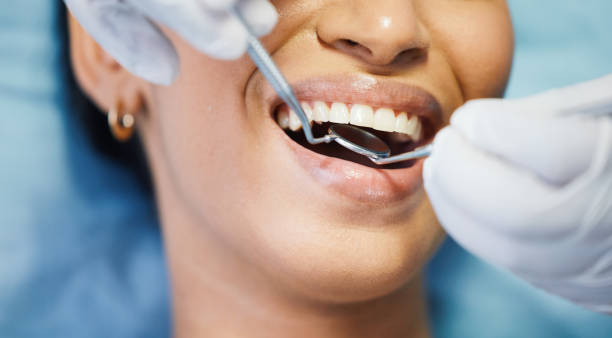 Best Urgent Care for Lost Fillings or Crowns in Marquette, MI